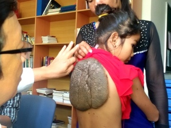 Bé gái mang bướu rùa khổng lồ cực hiếm gặp