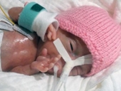Sự hồi sinh kỳ diệu của em bé chào đời chỉ hơn 200 gram