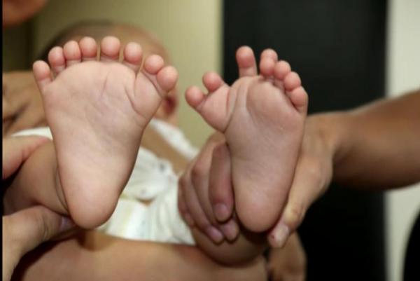  Bé trai có tổng cộng 16 ngón trên bàn tay và 15 ngón chân nhưng lại không có ngón tay cái hay ngón chân cái nào.