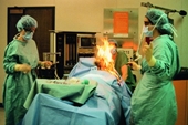 Bệnh nhân  xì hơi gây hỏa hoạn trong khi đang phẫu thuật