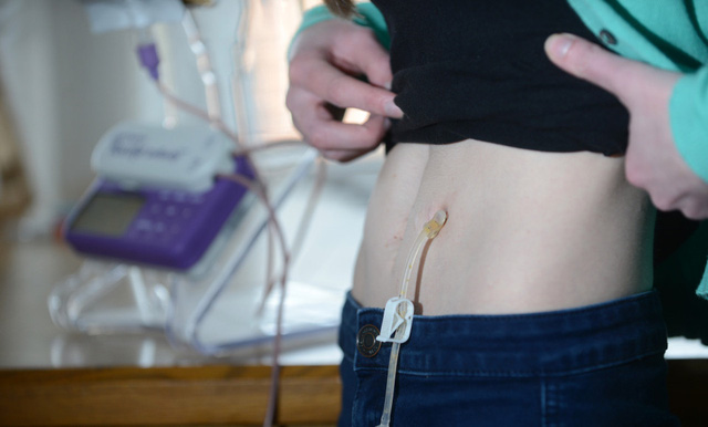 Cô gái không ăn không uống trong suốt 5 năm