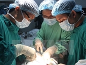 Phẫu thuật cắt bỏ thành công khối u nặng khoảng 1,2kg tại vùng cổ