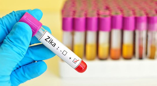 Đối mặt với Zika, quai bị, tay chân miệng và sốt xuất huyết