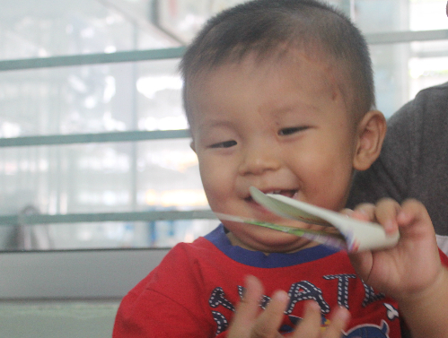 Cậu bé bị đâm xuyên não tròn 17 tháng tuổi, có di chứng nhẹ