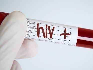 Sắp có văcxin trị HIV