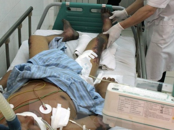 Ăn tiết canh lợn cắp nách, xuất hiện ban hoại tử khắp toàn thân