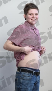 Chàng trai 20 tuổi mang thai nhờ phương pháp hiến tinh trùng