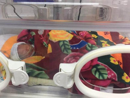 Bé gái nặng 800 g sinh non trong bọc ối vào ngày Tình yêu