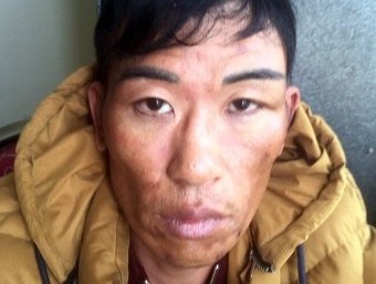 Trùm ma túy nuôi chó dữ, lắp camera bán hàng