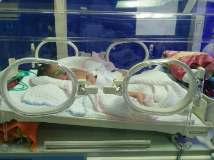 Bé sinh non cận thị bị bỏ rơi