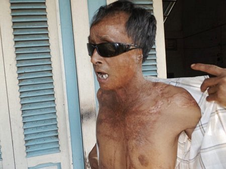 Toàn chuyện máy bay tàn độc với phi công ở Vĩnh Long