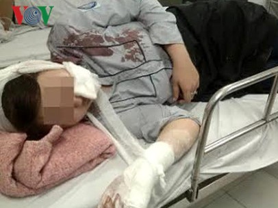 Nữ sinh 16 tuổi nghi bị đánh vào đầu ngã xuống đường