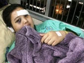 Diễn biến mới vụ cô gái trẻ bị cắt tai, đánh đập dã man giữa TP HCM
