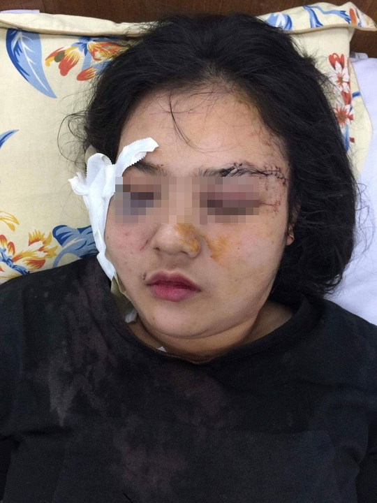 Cô gái trẻ bị nhóm côn đồ đâm chém dã man