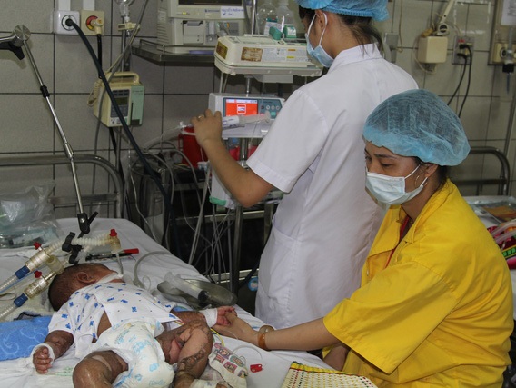 Gần 90 trẻ mắc ho gà chưa tiêm phòng