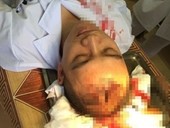 Bác sĩ bị người nhà bệnh nhi đánh trọng thương ở Thạch Thất, Hà Nội
