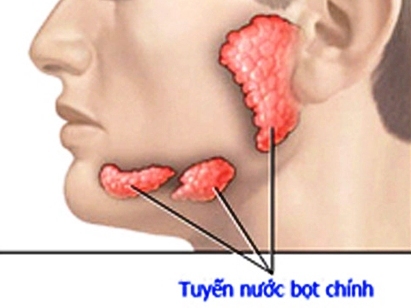 Xuất hiện dấu hiệu này bạn nên nghĩ đến ung thư tuyến nước bọt