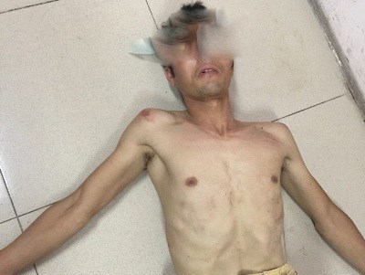 Giải cứu cô gái trẻ bị gã trai trói nghiến trong nhà nghỉ