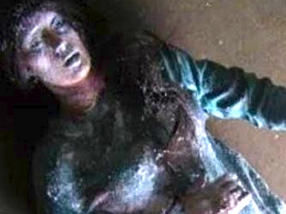 Cô gái hồi sinh sau một đêm bị đóng băng khiến y học không thể lý giải