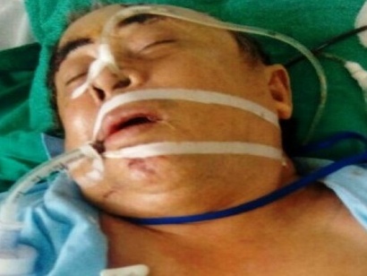 Mua nước chè không được, dùng dao truy sát cả nhà hàng xóm