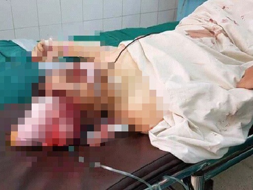 Mâu thuẫn gia đình, chồng dùng dao sát hại vợ rồi nhảy hồ tự tử