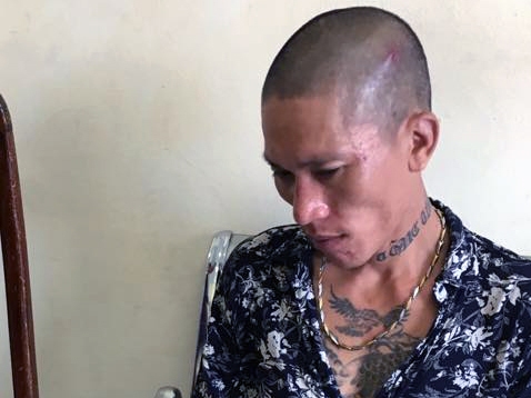 Hà Nội Khởi tố đối tượng nhiễm HIV tấn công CSGT