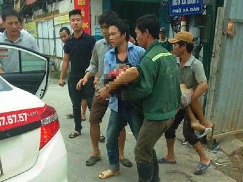 Hà Nội Điều tra vụ một người bị thương sau tiếng nổ lớn