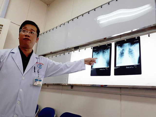 Thực hư vi rút lạ tấn công đạo diễn VTV